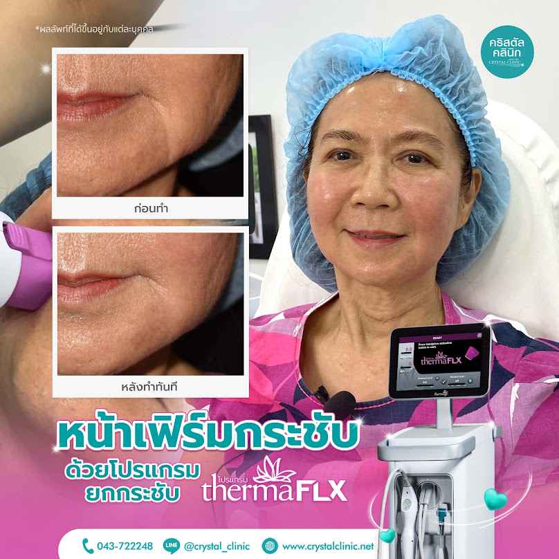 คริสตัลคลินิก รักษาสิว โรคผิวหนัง ผมร่วง ความงาม กำจัดไฝ ขี้แมลงวัน เลเซอร์ โบทอกซ์ ฟิลเลอร์ ลบรอยสัก กำจัดขนมหาสารคาม - 4