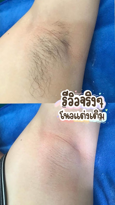 ร้านจิตดาวแว็กซ์กำจัดขนสุโขทัย