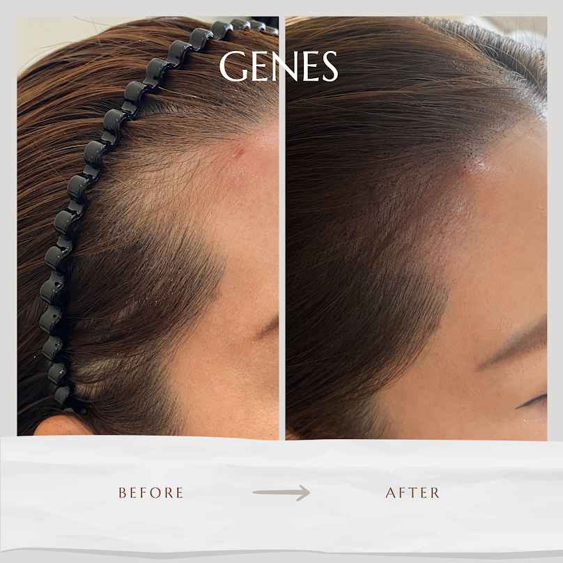 Genes hairsociety - 4
