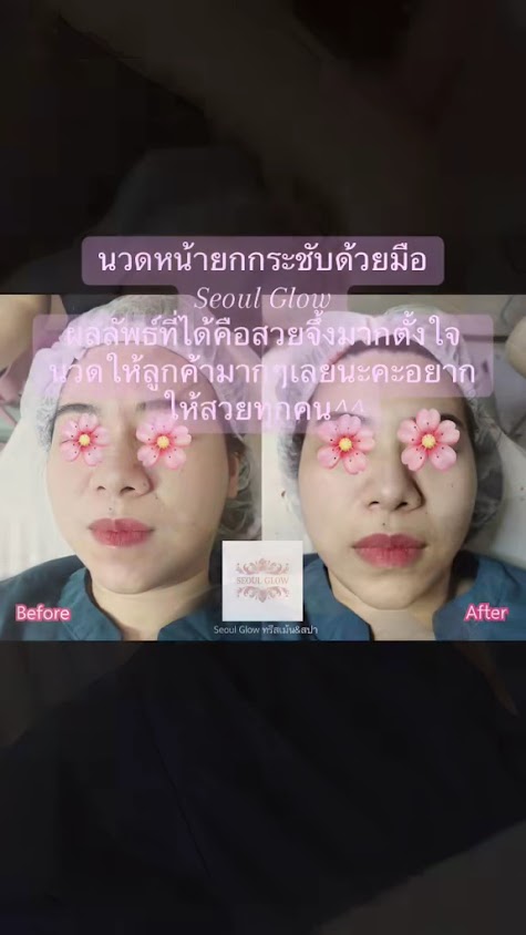 Seoul Glow ทรีสเม้น&สปา(นวดหน้าโดยผู้เชี่ยวชาญ นวดศรีษะน้ำมันร้อน สระผมสไตล์เวียดนาม ระเบิดขี้ไคล) - 3