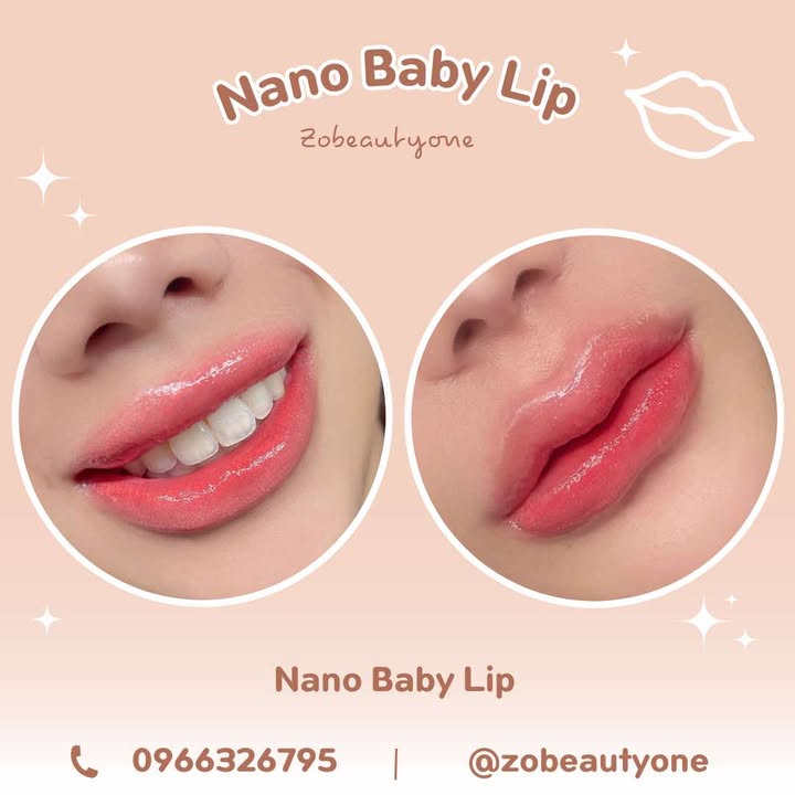 ZO BEAUTY ONE - ศูนย์ความงามครบวงจร